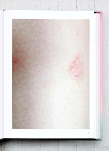 TOPEAUGRAPHIE SERIES By FRANCESCA DI BONITO